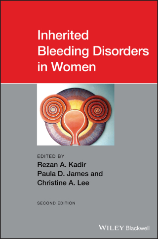 表紙画像: Inherited Bleeding Disorders in Women 2nd edition 9781119426028