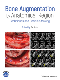 Cover image: Bone Augmentation by Anatomical Region 1st edition 9781119427841