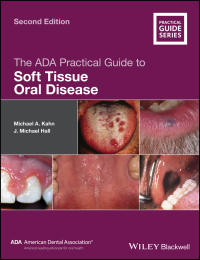 Cover image: The ADA Practical Guide to Soft Tissue Oral Disease 2nd edition 9781119437338