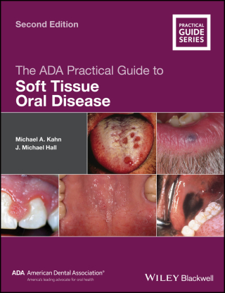 Cover image: The ADA Practical Guide to Soft Tissue Oral Disease 2nd edition 9781119437338