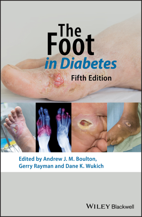 The Foot in Diabetes, 5th Edition, 5th Edition - FULL INSTANT DOWNLOAD | PDF DOCX EPUB