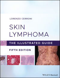 Cover image: Skin Lymphoma 5th edition 9781119485902