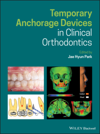 صورة الغلاف: Temporary Anchorage Devices in Clinical Orthodontics 1st edition 9781119513476