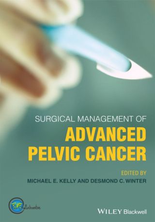 Omslagafbeelding: Surgical Management of Advanced Pelvic Cancer 1st edition 9781119518402