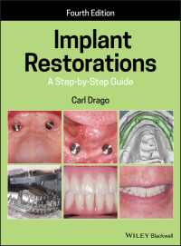 Titelbild: Implant Restorations 4th edition 9781119538110