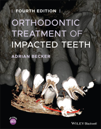 Imagen de portada: Orthodontic Treatment of Impacted Teeth, 4th Edition 4th edition 9781119565376