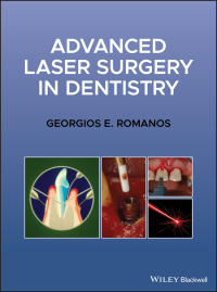 Cover image: Advanced Laser Surgery in Dentistry 1st edition 9781119583301