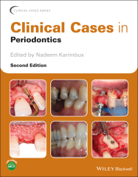 Manual of Clinical Periodontics: 9789352702237: Medicine