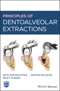 صورة الغلاف: Principles of Dentoalveolar Extractions 1st edition 9781119596400