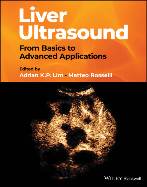 Liver Ultrasound: From Basics to Advanced Applications, 1st Edition - FULL INSTANT DOWNLOAD | PDF DOCX EPUB