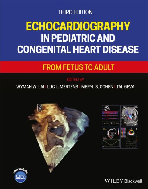 Echocardiography in Pediatric and Congenital Heart Disease: From Fetus to Adult, 3rd Edition: From Fetus to Adult, 3rd Edition - FULL INSTANT DOWNLOAD | PDF DOCX EPUB