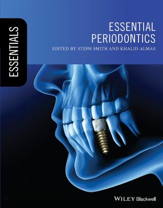 Imagen de portada: Essential Periodontics 1st edition 9781119619628