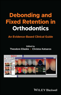 Cover image: Debonding and Fixed Retention in Orthodontics 1st edition 9781119623953