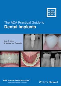 Imagen de portada: The ADA Practical Guide to Dental Implants 1st edition 9781119630692