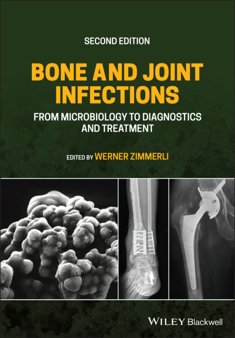 Bone and Joint Infections: From Microbiology to Diagnostics and Treatment, 2nd Edition - FULL INSTANT DOWNLOAD | PDF DOCX EPUB