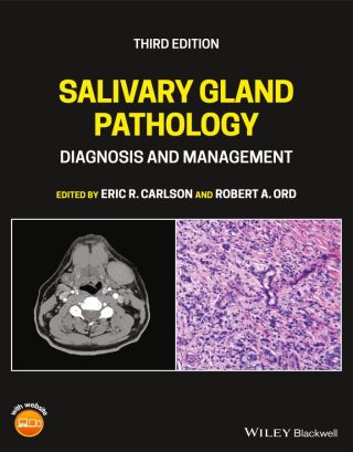 表紙画像: Salivary Gland Pathology: Diagnosis and Management 3rd edition 9781119730187