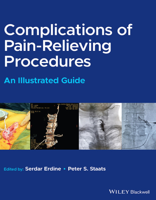 Imagen de portada: Complications of Pain-Relieving Procedures: An Illustrated Guide 1st edition 9781119757276
