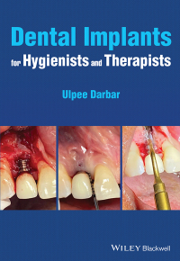 Cover image: Dental Implants for Hygienists and Therapists 1st edition 9781119763826