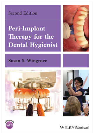 Cover image: Peri-Implant Therapy for the Dental Hygienist 2nd edition 9781119766186