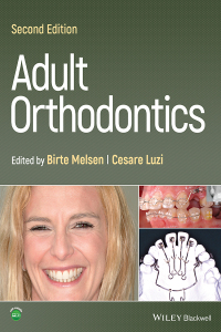 صورة الغلاف: Adult Orthodontics, 2nd Edition 2nd edition 9781119775775