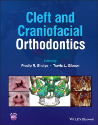 Imagen de portada: Cleft and Craniofacial Orthodontics 1st edition 9781119778349