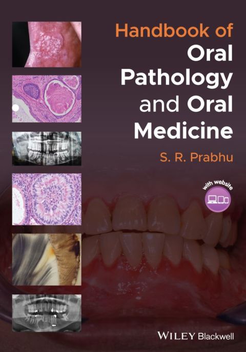 Handbook of Oral Pathology and Oral Medicine, 1st Edition - FULL INSTANT DOWNLOAD | PDF DOCX EPUB