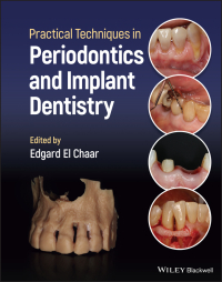 Imagen de portada: Practical Techniques in Periodontics and Implant Dentistry 1st edition 9781119793557
