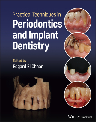 Cover image: Practical Techniques in Periodontics and Implant Dentistry 1st edition 9781119793557