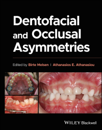 Cover image: Dentofacial and Occlusal Asymmetries 1st edition 9781119794813