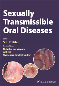 Imagen de portada: Sexually Transmissible Oral Diseases 1st edition 9781119826750