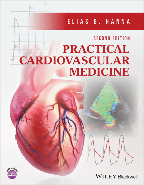 Practical Cardiovascular Medicine, 2nd Edition - FULL INSTANT DOWNLOAD | PDF DOCX EPUB