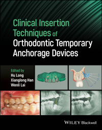 Titelbild: Clinical Insertion Techniques of Orthodontic Temporary Anchorage Devices 1st edition 9781119892236