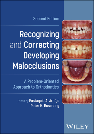 Cover image: Recognizing and Correcting Developing Malocclusions 2nd edition 9781119912545