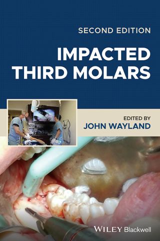Cover image: Impacted Third Molars 2nd edition 9781119930303