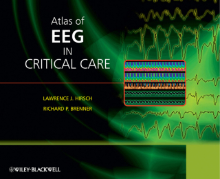 صورة الغلاف: Atlas of EEG in Critical Care 1st edition 9780470987865