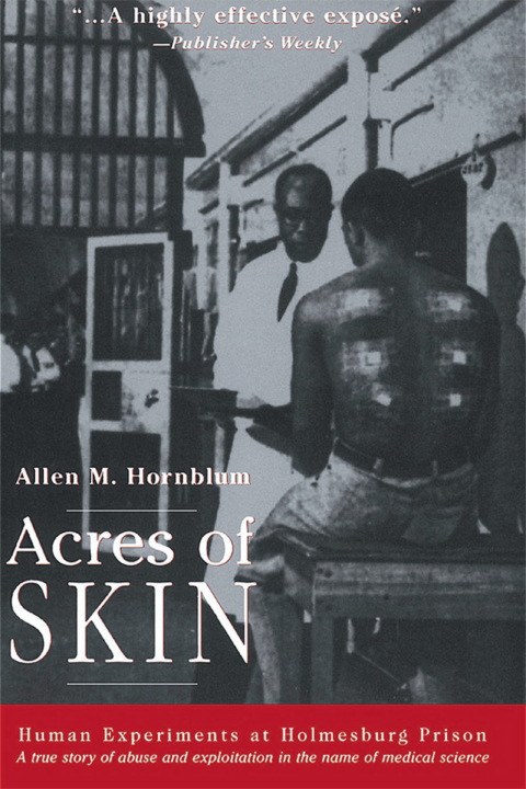 Acres of Skin: Human Experiments at Holmesburg Prison, 1st Edition - FULL INSTANT DOWNLOAD | PDF DOCX EPUB