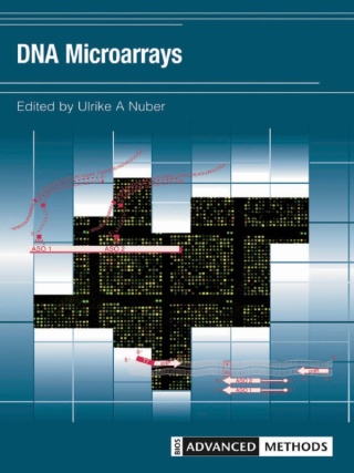 Imagen de portada: DNA Microarrays 1st edition 9780415358668