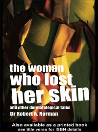 صورة الغلاف: The Woman Who Lost Her Skin 1st edition 9781138416734