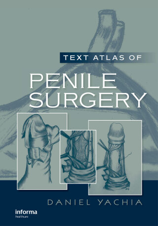 Cover image: Text Atlas of Penile Surgery 1st edition 9781841845173