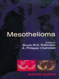 Cover image: Mesothelioma 1st edition 9780367396374
