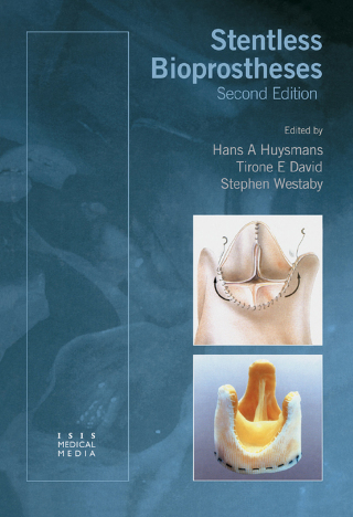 Cover image: Stentless Bioprostheses 1st edition 9781899066186