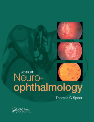 Cover image: Atlas of Neuro-ophthalmology 1st edition 9781853177736