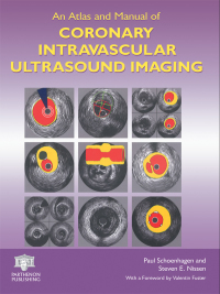 Cover image: An Atlas and Manual of Coronary Intravascular Ultrasound Imaging 1st edition 9781842142745