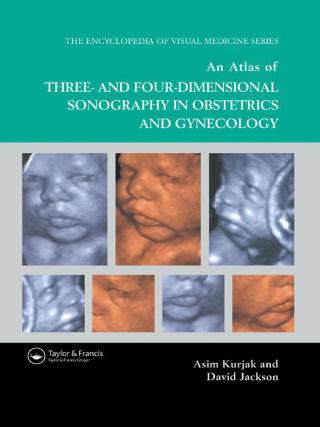 Cover image: An Atlas of Three- and Four-Dimensional Sonography in Obstetrics and Gynecology 1st edition 9781842142387