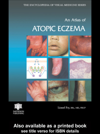 Titelbild: An Atlas of Atopic Eczema 1st edition 9781842142363