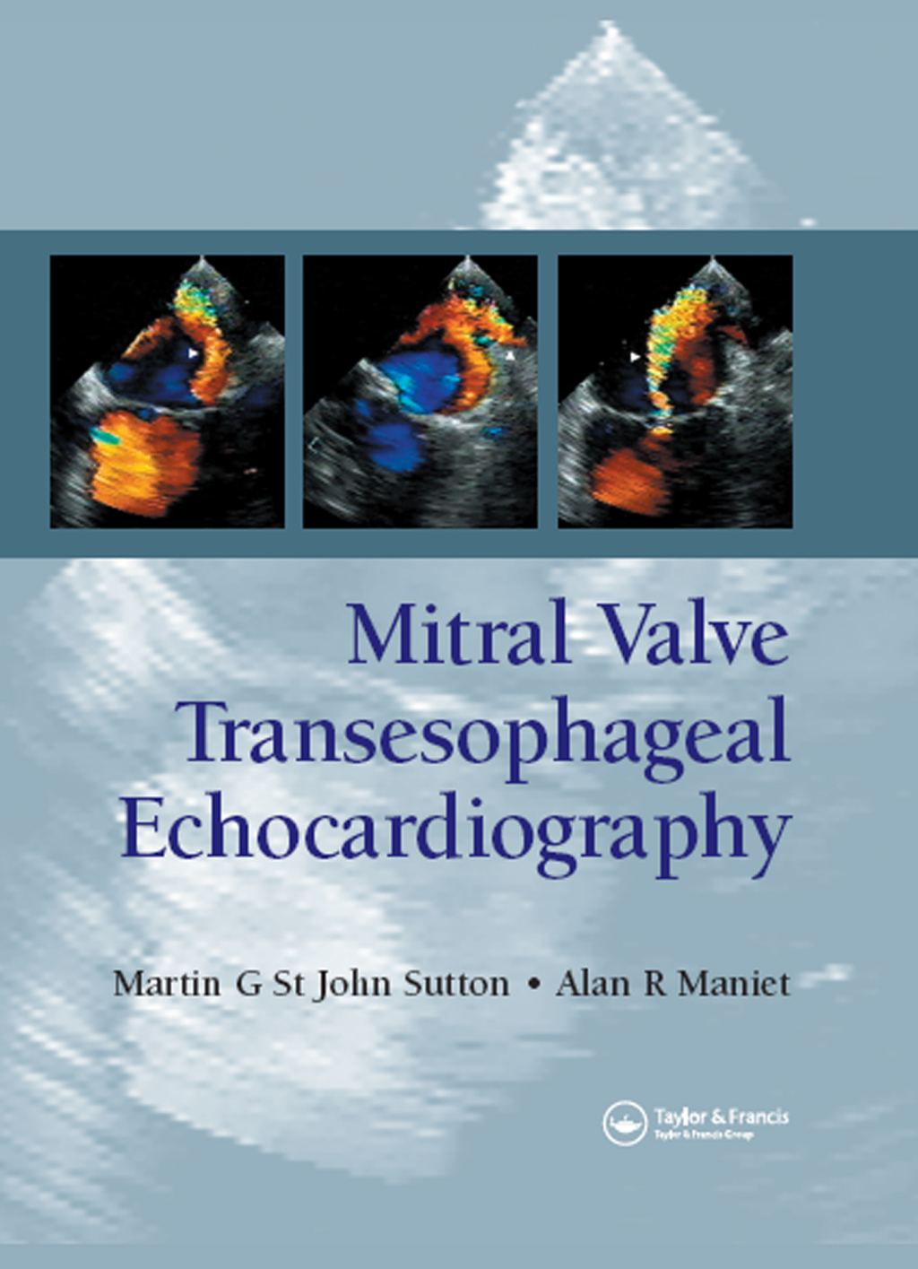 Mitral Valve Transesophageal Echocardiography 1st Edition