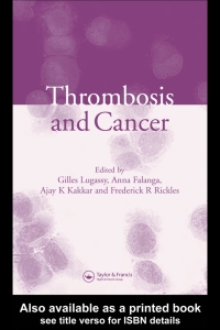 Imagen de portada: Thrombosis and Cancer 1st edition 9781841842875
