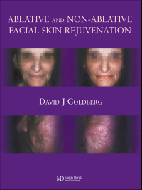 Omslagafbeelding: Ablative and Non-ablative Facial Skin Rejuvenation 1st edition 9781841841755
