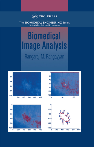 Omslagafbeelding: Biomedical Image Analysis 1st edition 9780849396953