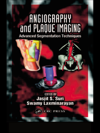 صورة الغلاف: Angiography and Plaque Imaging 1st edition 9780849317408